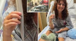 Jersey shore lifeguard impaled by umbrella in freak accident is back at the beach: ‘It’s all good’