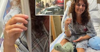 Jersey shore lifeguard impaled by umbrella in freak accident is back at the beach: ‘It’s all good’