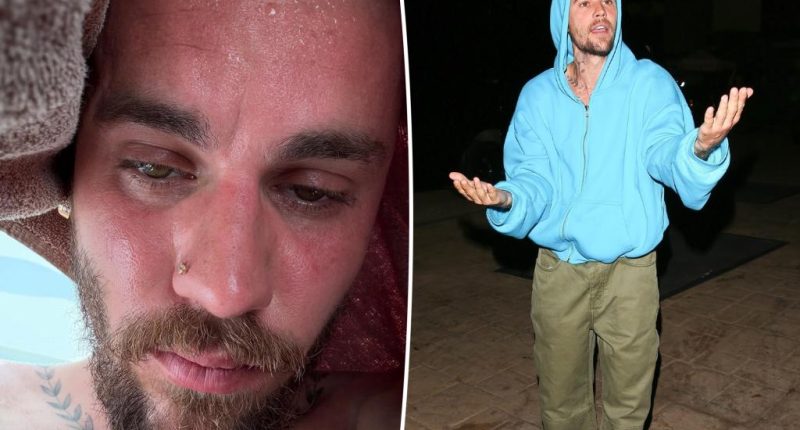 Justin Bieber shares sweaty ‘detox’ selfies as fans show support: ‘Please stay healthy and happy’