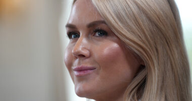 Karoline Leavitt's Apparent New Lip Filler Does Her Dirty On Scotland Trip With Trump