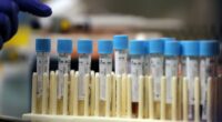 Medical Journals Flooded With AI Generated 'Research'