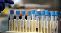 Medical Journals Flooded With AI Generated 'Research'