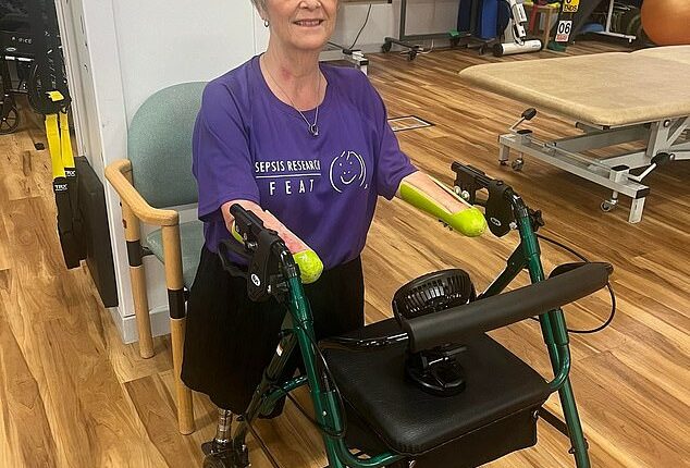 Kim Smith is now a quadruple amputee after a urinary tract infection went untreated for too long and she developed sepsis