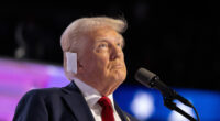 Plastic Surgeon Walks Us Through Trump's Ear Injury One Year After Assassination Attempt