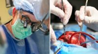 Researchers try new ways of preserving more hearts for transplants