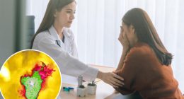 This already-common cancer — and its deadliness — will significantly increase in the next 25 years: study