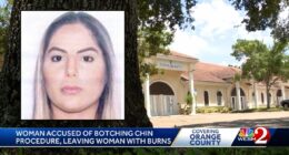 'Beyond illegal and full of scams': Unlicensed cosmetic procedures landed woman in hospital with 'necrosis of the chin area,' police say