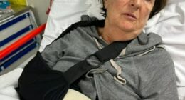 Koljibabic said the very painful impact shattered her wrist, requiring surgery and a metal plate