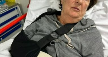 Koljibabic said the very painful impact shattered her wrist, requiring surgery and a metal plate