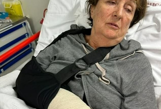 Koljibabic said the very painful impact shattered her wrist, requiring surgery and a metal plate