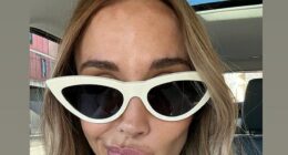 Bec Judd (pictured) has taken to social media to announce she has undergone another cosmetic procedure that has left her feeling like a 'pin cushion'