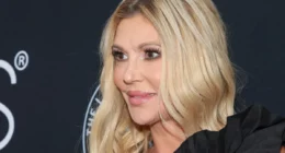 Brandi Glanville’s DIY Nair Hack for Facial Parasite ‘Can Cause Chemical Burns,’ Doctor Warns