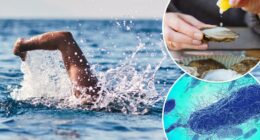 How to protect yourself against flesh-eating bacteria — as deadly infection sweeps 5 states