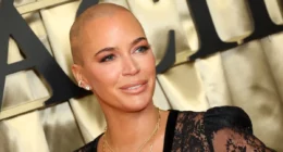 Teddi Mellencamp ‘Truly’ Believes She Will Live Despite ’50/50′ Chance of Cancer Survival